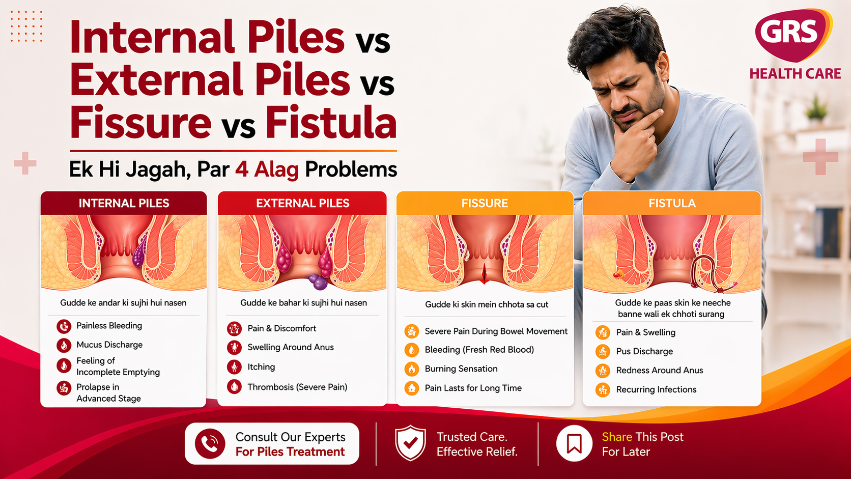 Internal Piles vs External Piles vs Fissure vs Fistula – Samjhein Farq Aasan Bhasha Mein